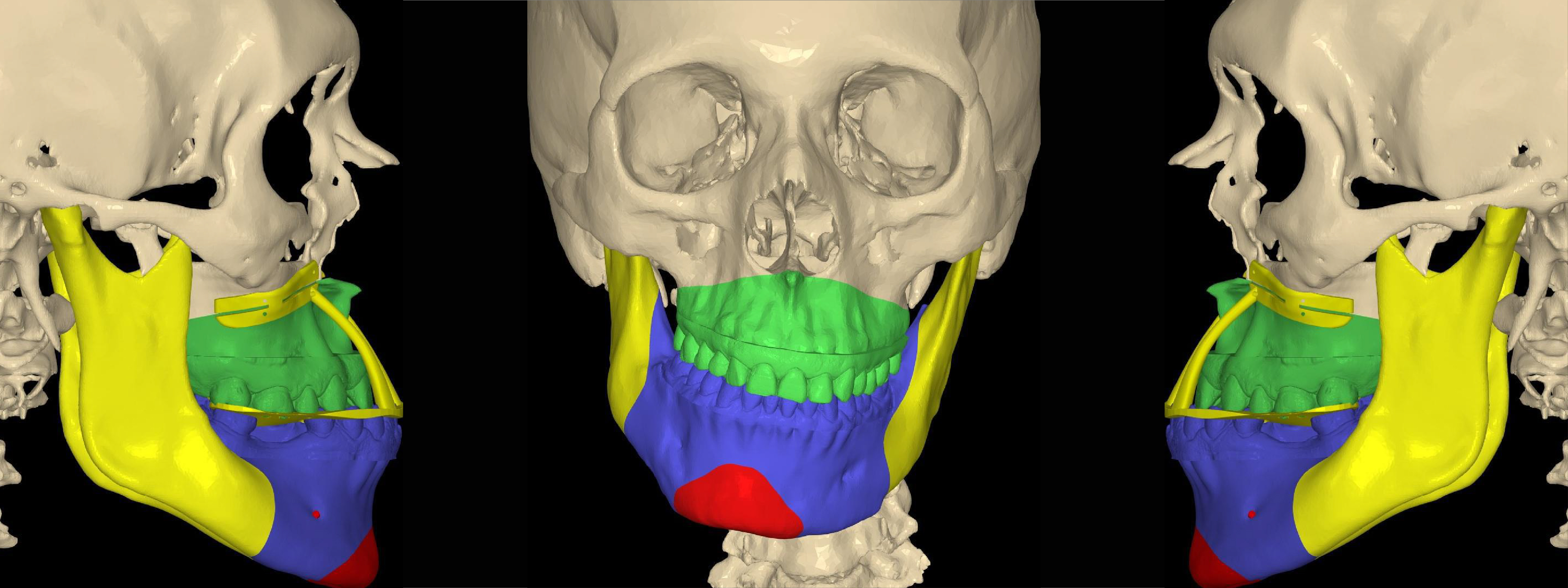 Radiografía Intrabucal